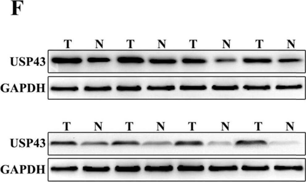  Detection of USP43 expression in colorectal cancer. A. The expression level of USP43 was verified in GEPIA database (//gepia.cancer-pku.cn/). B. qRT-PCR analysis of USP43 expression level in colorectal cancer tissues and normal tissues. C. The sample distribution analysis of the high expression in tumor tissue and high expression in adjacent tissues among 50 pairs of specimens. D. Detection of USP43 expression levels in colorectal cancer tissues and normal tissues with IHC. E. IHC score statistics of the USP43 expression levels in 50 colorectal cancer tissues and normal tissues. F. Western blot analysis of the USP43 expression level in colorectal cancer tissues and normal tissues. *P<0.05, ***P<0.001. Image collected and cropped by CiteAb from the following open publication (//pubmed.ncbi.nlm.nih.gov/33391437), licensed under a CC-BY license. Not internally tested by Novus Biologicals.