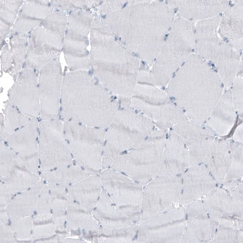 Staining of human skeletal muscle shows no positivity in myocytes as expected.