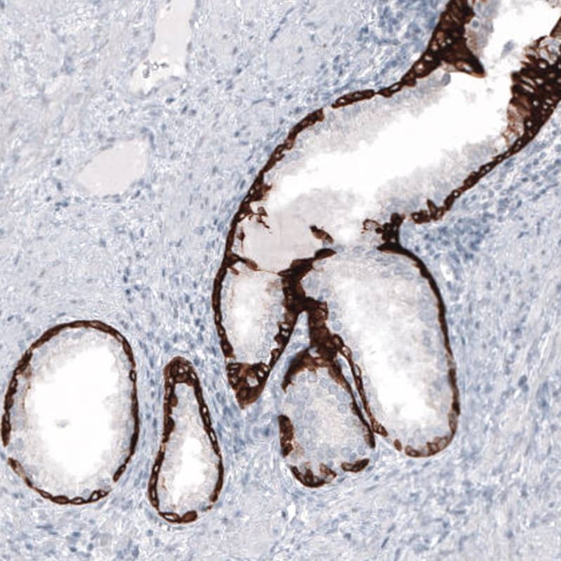 Staining of human prostate shows strong cytoplasmic positivity in glandular cells.