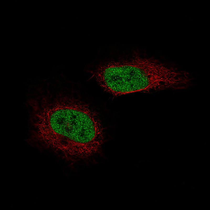 Staining of U-2 OS cells, showing specific staining in the nucleoplasm in green. Microtubule- and nuclear probes are visualized in red and blue, respectively (where available).