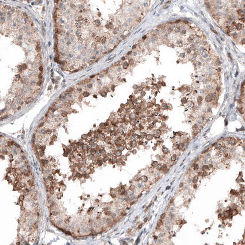 Staining of human testis shows moderate cytoplasmic positivity in cells in seminiferous ducts.