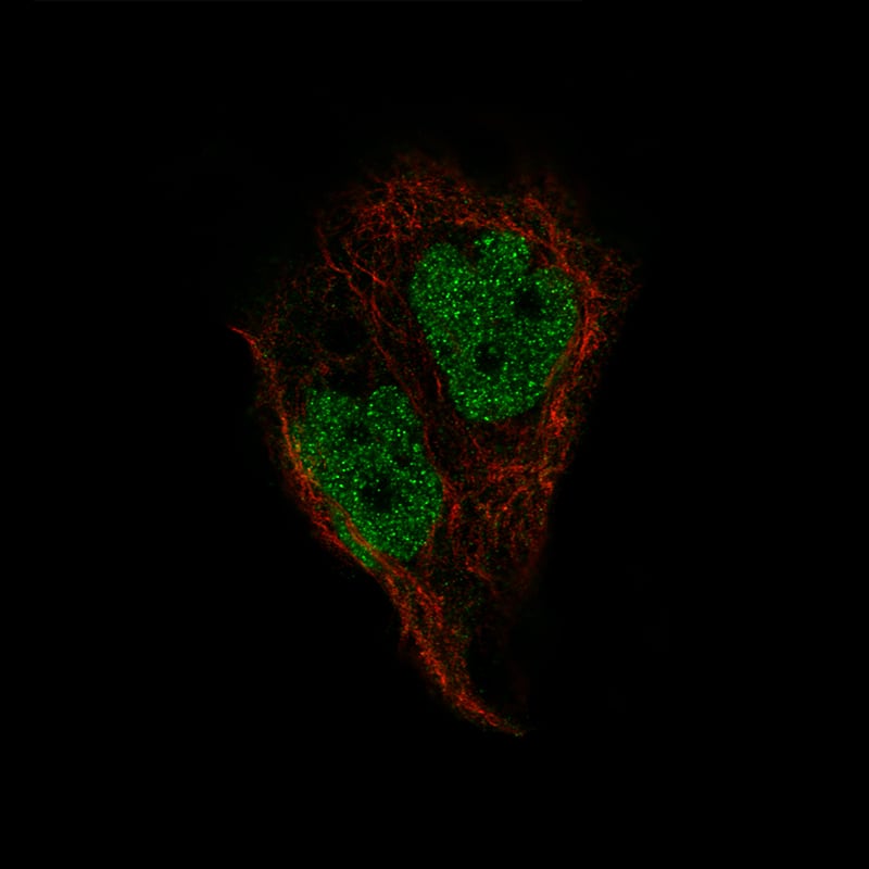 Staining of EFO-21 cells, showing specific staining in the nucleoplasm in green. Microtubule- and nuclear probes are visualized in red and blue, respectively (where available).