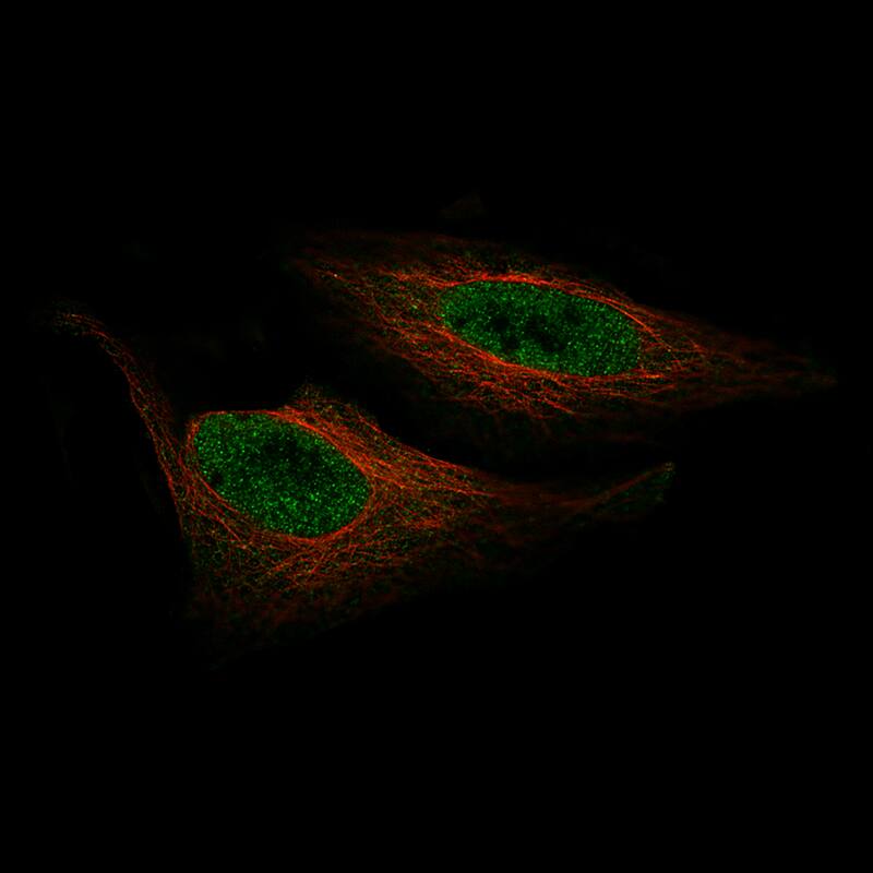 Staining of HeLa cells, showing specific staining in the nucleoplasm in green. Microtubule- and nuclear probes are visualized in red and blue, respectively (where available).