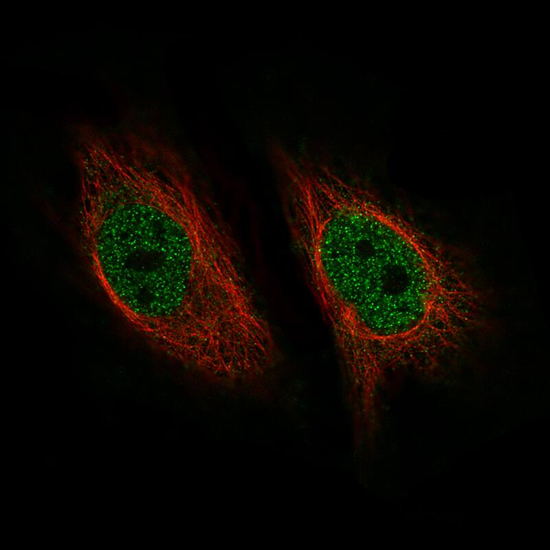 Staining of HeLa cells, showing specific staining in the nucleoplasm in green. Microtubule- and nuclear probes are visualized in red and blue, respectively (where available).