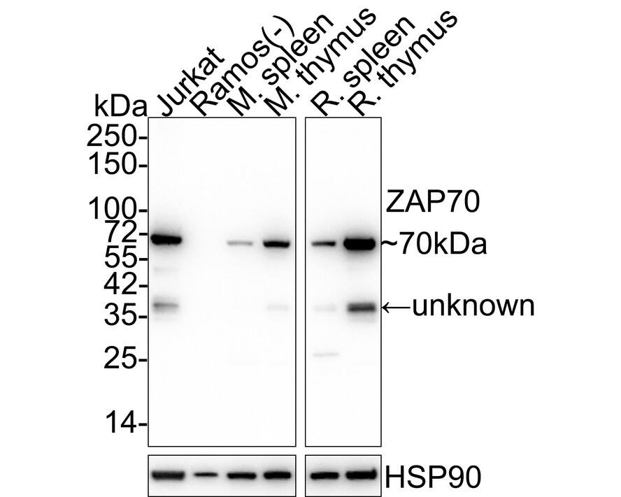Western blot analysis on different lysates with NBP2-89121 at 1/1,000 dilution. Lane 1: Jurkat cell lysate Lane 2: Ramos cell lysate (negative) Lane 3: Mouse spleen tissue lysate Lane 4: Mouse thymus tissue lysate Lane 5: Rat spleen tissue lysate Lane 6: Rat thymus tissue lysate Lysates/proteins at 20 µg/Lane. Predicted band size: 70 kDa Observed band size: 70 kDa Exposure time: 43 seconds; 4-20% SDS-PAGE gel. Proteins were transferred to a PVDF membrane and blocked with 5% NFDM/TBST for 1 hour at room temperature. NBP2-89121 at 1/1,000 dilution was used in 5% NFDM/TBST at 4℃ overnight. Goat anti-Mouse IgG [HRP] at 1/50,000 dilution was used for 1 hour at room temperature.
