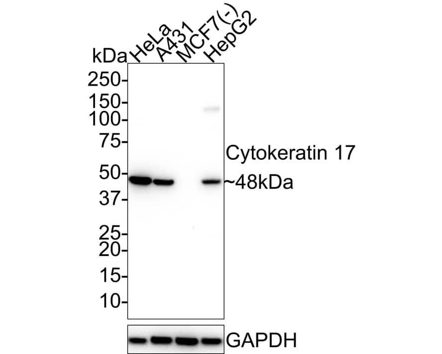 Western blot analysis on different lysates with NBP2-89123 at 1/1,000 dilution. Lane 1: HeLa cell lysate Lane 2: A431 cell lysate Lane 3: MCF7 cell lysate (negative) Lane 4: HepG2 cell lysate Lysates/proteins at 20 µg/Lane. Predicted band size: 48 kDa Observed band size: 48 kDa Exposure time: 5 seconds; 4-20% SDS-PAGE gel. Proteins were transferred to a PVDF membrane and blocked with 5% NFDM/TBST for 1 hour at room temperature. NBP2-89123 at 1/1,000 dilution was used in 5% NFDM/TBST at 4℃ overnight. Goat anti-Mouse IgG [HRP] at 1/50,000 dilution was used for 1 hour at room temperature.