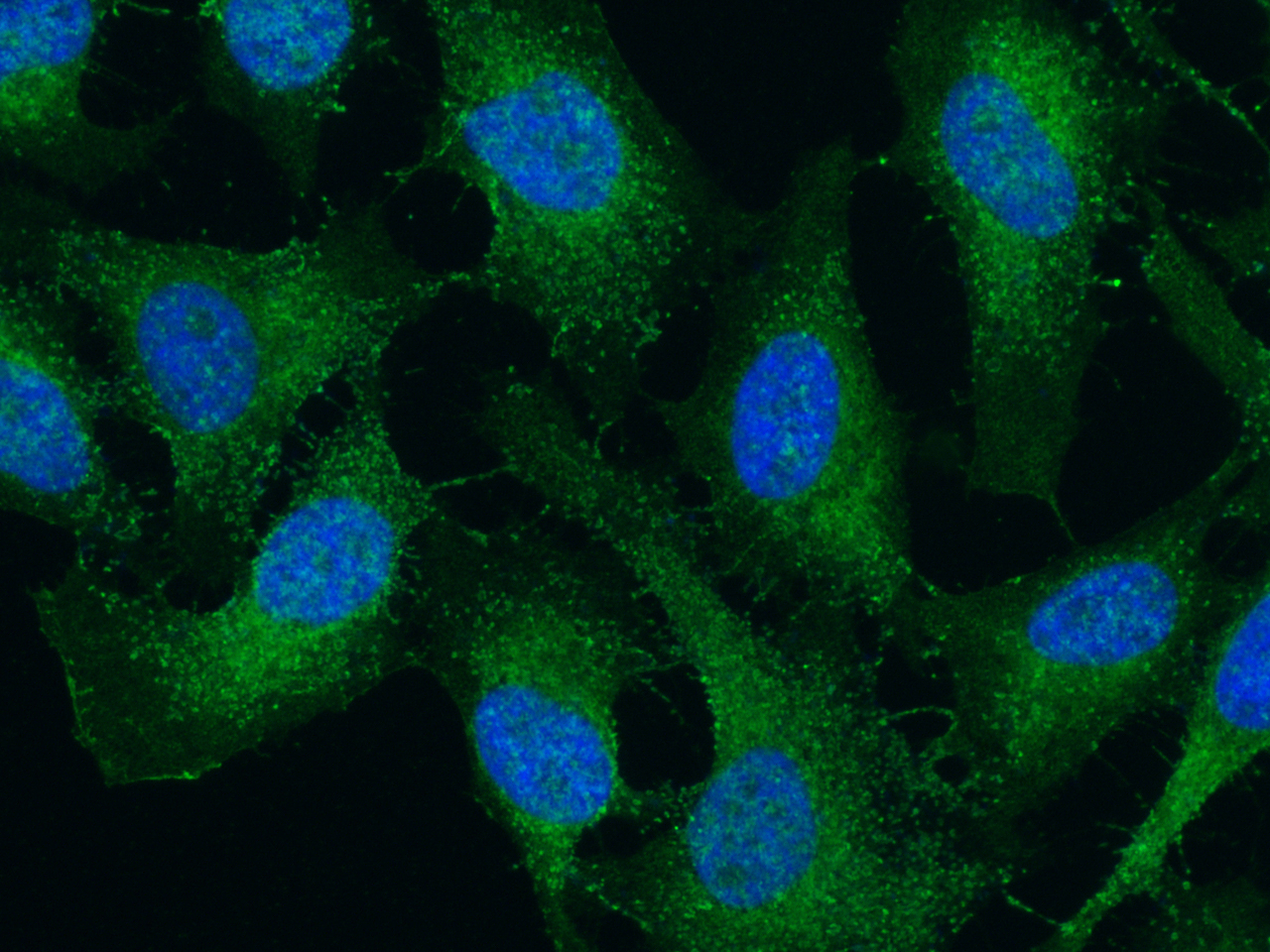 Immunocytochemistry/ Immunofluorescence: SMAC/Diablo Antibody (006) [NBP2-89251] - Immunofluorescence staining of Human SMAC/Diablo in Hela cells. Cells were fixed with 4% PFA, permeabilzed with 0.3% Triton X-100 in PBS, blocked with 10% serum, and incubated with NBP2-89251 (1:60) at 4 overnight. Then cells were stained with the Alexa Fluor 488-conjugated Goat Anti-rabbit IgG secondary antibody (green) and counterstained with DAPI (blue). Positive staining was localized to cytoplasm.