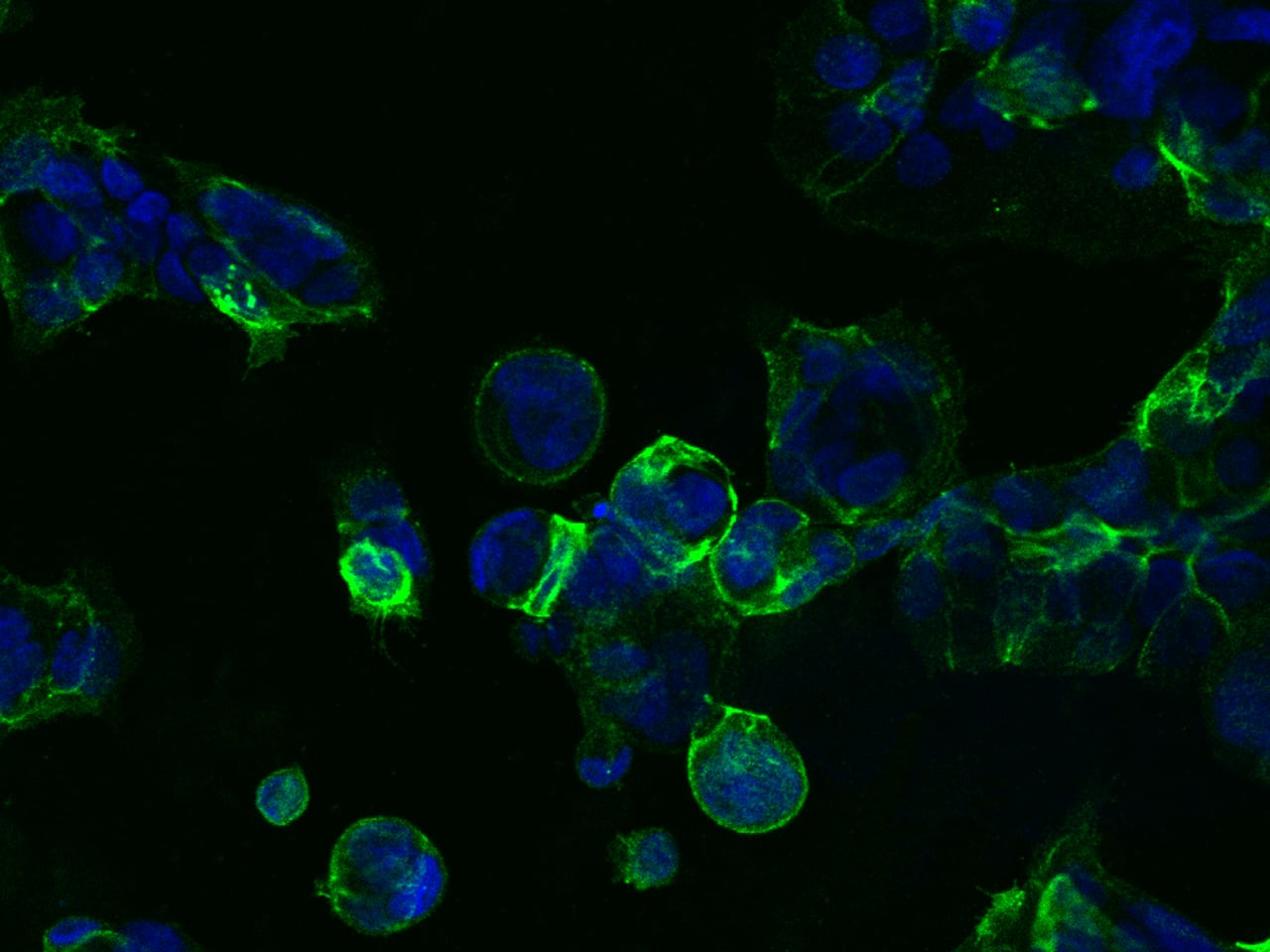 Immunocytochemistry/ Immunofluorescence: TROP-2 Antibody (001) [NBP2-89492] - Immunofluorescence staining of TROP-2 in NCI-N87 cells. Cells were fixed with 4% PFA, blocked with 10% serum, and incubated with NBP2-89492 (dilution ratio 1:60) at 4C overnight. Then cells were stained with the Goat Anti-rabbit IgG secondary antibody [Alexa Fluor 488] (green) and counterstained with DAPI (blue). Positive staining was localized to Cell membrane.