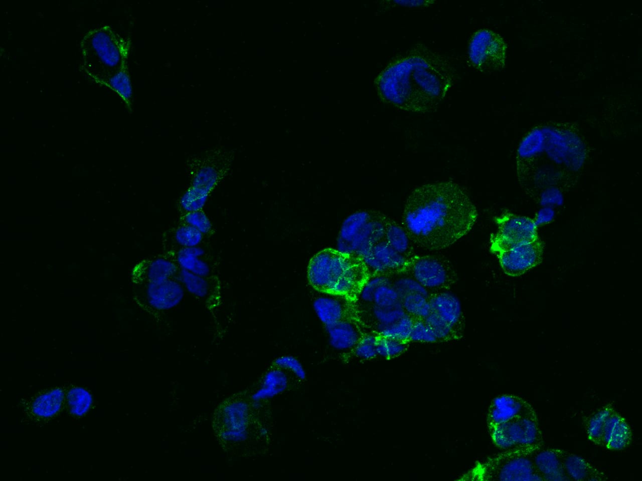Immunocytochemistry/ Immunofluorescence: TROP-2 Antibody (020) [NBP2-89493] - Immunofluorescence staining of TROP-2 in NCI-N87 cells. Cells were fixed with 4% PFA,blocked with 10% serum, and incubated with NBP2-89493 (dilution ratio 1:60) at 4C overnight. Then cells were stained with the Goat Anti-rabbit IgG secondary antibody [Alexa Fluor 488] (green) and counterstained with DAPI (blue). Positive staining was localized to Cell membrane.