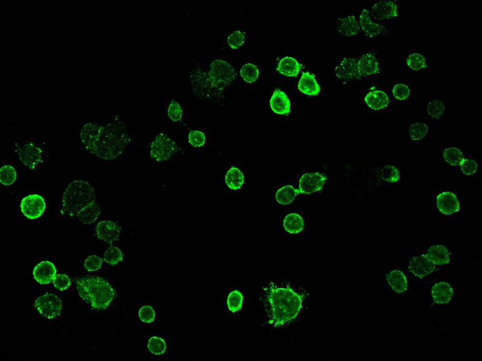Immunocytochemistry/Immunofluorescence: TROP-2 Antibody (020) [NBP2-89493] - Staining of TROP2 in SKBR3 cells. Cells were fixed with 4% PFA,blocked with 10% serum, and incubated with NBP2-89493 antibody (dilution ratio 1:60) at 4co overnight. Then cells were stained with the Alexa Fluor(R)488-conjugated Goat Anti-rabbit IgG secondary antibody (green). Positive staining was localized to.