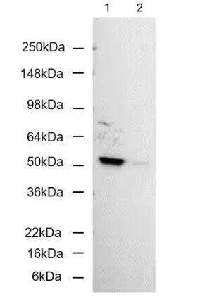 Western Blot: Rabbit Monoclonal Carbonic Anhydrase XIV/CA14 Antibody (515) [NBP2-89510] - 20ug/lane human melanoma cancer cell lysates (Lane #1 SKMEL3, Lane #2 M202), blotted with Carbonic Anhydrase XIV/CA14 antibody. Image from a verified customer review.