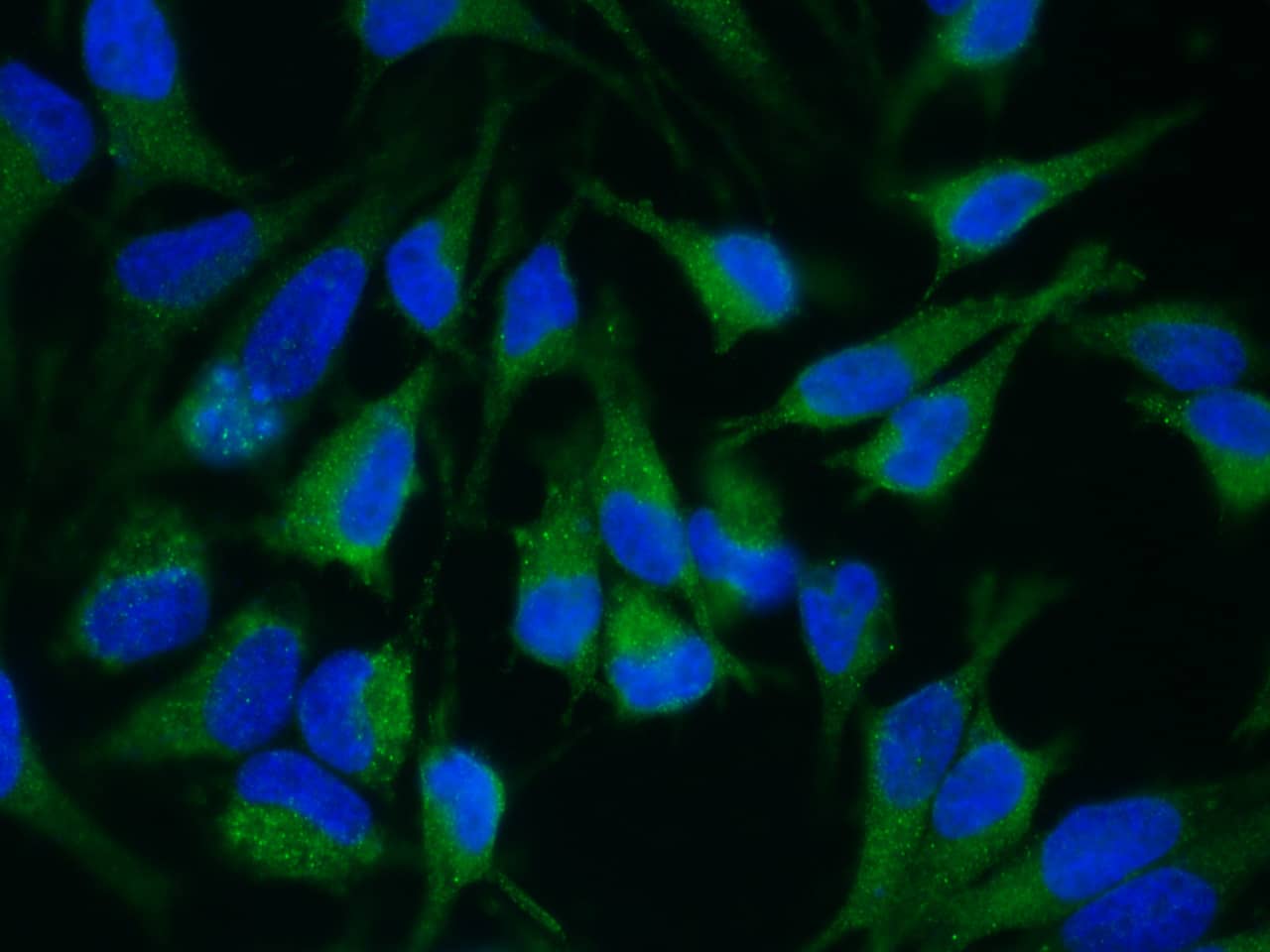 Immunocytochemistry/Immunofluorescence: ADAM15 Antibody (007) [NBP2-89546] - Staining of Human ADAM15 in Hela cells. Cells were fixed with 4% PFA, permeabilzed with 1% Triton X-100 in PBS, blocked with 10% serum, and incubated with NBP2-89546 antibody (1:60) at 37c 1 hour. Then cells were stained with the Alexa Fluor(R) 488-conjugated Goat Anti-rabbit IgG secondary antibody (green). Positive staining was localized to cytoplasm.