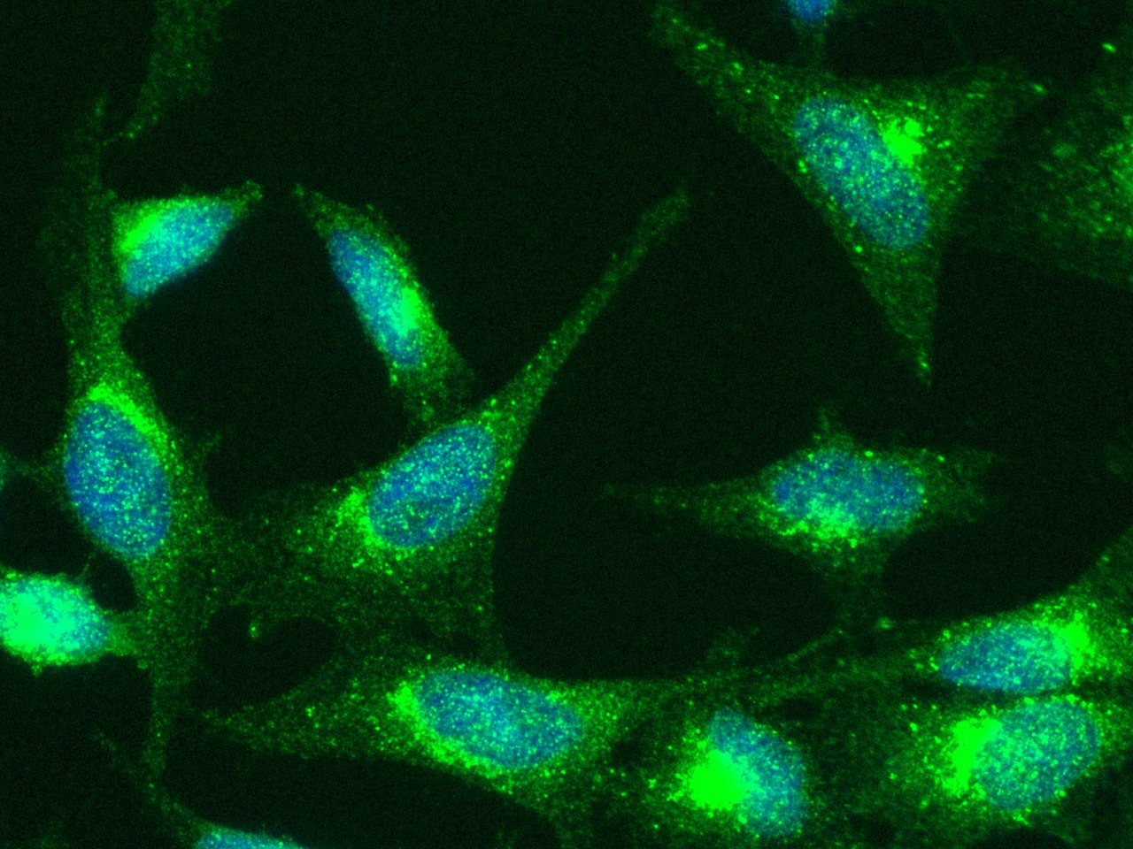 Immunocytochemistry/Immunofluorescence: TNF RI/TNFRSF1A Antibody (001) [NBP2-89687] - Staining of Human TNFRI in Hela cells. Cells were fixed with 4% PFA, permeabilzed with 0.3% Triton X-100 in PBS, blocked with 10% serum, and incubated with NBP2-89687 antibody (1:60) at 4c overnight. Then cells were stained with the Alexa Fluor(R) 488-conjugated Goat Anti-rabbit IgG secondary antibody (green) and counterstained with DAPI (blue). Positive staining was localized to cytoplasm.