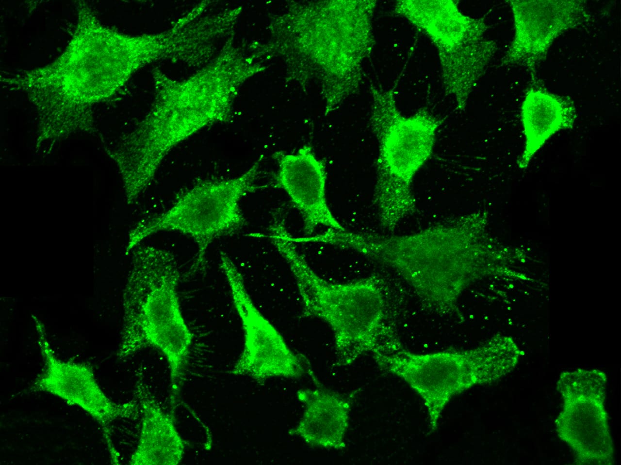 Immunocytochemistry/Immunofluorescence: MESDC2 Antibody (502) [NBP2-89719] - Staining of Mesdc2 in Hela cells. Cells were fixed with 4% PFA, permeabilzed with 0.1% Triton X-100 in PBS,blocked with 10% serum, and incubated with NBP2-89719 antibody (dilution ratio 1:60) at 4c overnight. Then cells were stained with the Alexa Fluor(R)488-conjugated Goat Anti-rabbit IgG secondary antibody (green). Positive staining was localized to Cytoplasm.