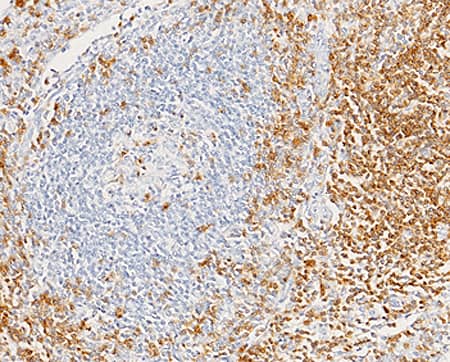 Immunohistochemistry-Paraffin: CD7 Antibody (015) [NBP2-89748] - Staining of human CD7 in human lymphoid node with NBP2-89748 (1:200). Positive staining was localized to membrane of T cells.