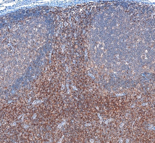 Immunohistochemistry CD8 beta Antibody (039)