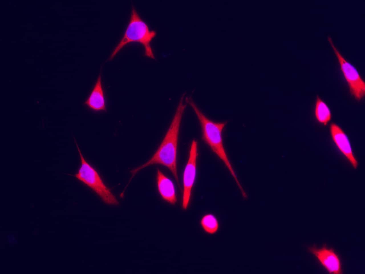 <b>Biological Strategies Validation. </b>Immunocytochemistry/Immunofluorescence: S100A7/Psoriasin Antibody (128) [NBP2-89813] - Analysis of Human S100A7 in Hela cells. Cells were fixed with 4% PFA, permeabilzed with 1% Triton X-100 in PBS, blocked with 10% serum, and incubated with NBP2-89813 antibody (1:60). Then cells were stained with the Alexa Fluor(R)594-conjugated Goat Anti-rabbit IgG secondary antibody. Positive staining was localized to cytoplasm.