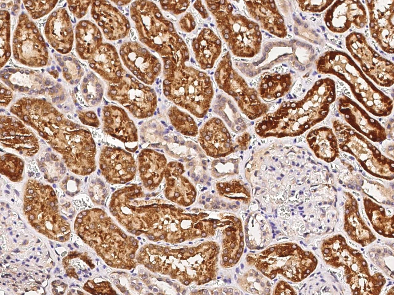 Immunohistochemistry-Paraffin: CD39L4/CD39L4/ENTPD5 Antibody (064) [NBP2-89830] - Immunochemical staining of human CD39L4/ENTPD5 in human kidney with NBP2-89830 at 1:1000 dilution, formalin-fixed paraffin embedded sections.