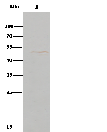 Immunoprecipitation: CD39L4/ENTPD5 Antibody (064) [NBP2-89830] - ENTPD5 was immunoprecipitated using: Lane A:0.5 mg HepG2 Whole Cell Lysate 0.5 uL NBP2-89830 and 15 ul of 50 % Protein G agarose. Primary antibody: NBP2-89830 at 1:500 dilution. Secondary antibody: Clean-Bloto IP Detection Reagent (HRP) at 1:1000 dilution. Developed using the DAB staining technique. Performed under reducing conditions. Predicted band size: 47 kDa Observed band size: 47 kDa 