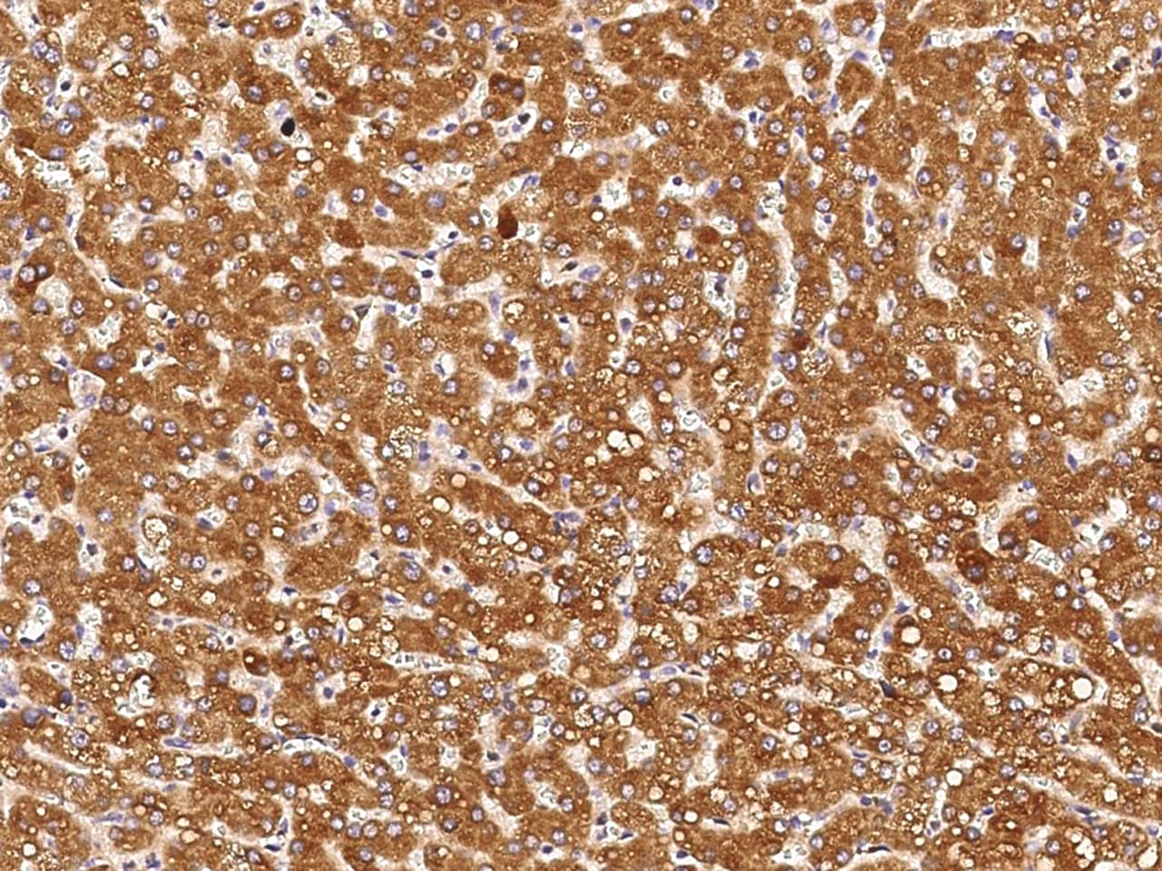 Immunohistochemistry-Paraffin: CD39L4/CD39L4/ENTPD5 Antibody (064) [NBP2-89830] - Immunochemical staining of human CD39L4/ENTPD5 in human liver with NBP2-89830 at 1:1000 dilution, formalin-fixed paraffin embedded sections.