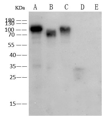 NBP2-89960 used at 1:1000 dilution. Lane A: H3N2 (A/Darwin/9/2021) HA Protein. Lane B: H3N2 (A/Darwin/9/2021) HA Protein. Lane C: H3N2 (A/Darwin/6/2021) HA Protein. Lane D: Influenza B (B/Austria/1359417/2021)(Victoria lineage) HA Protein. Lane E: Influenza B (B/Austria/1359417/2021)(Victoria lineage) HA Protein. Secondary Goat Anti-Rabbit IgG (H+L)[HRP] used at at 1/10000 dilution. Developed using the ECL technique. Performed under reducing conditions.