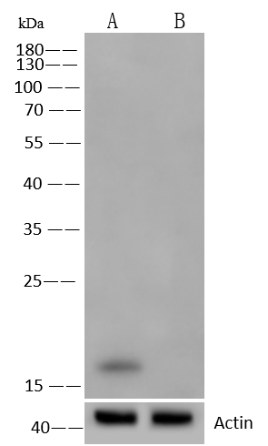 <b>Genetic Strategies Validation. </b>Western Blot: alpha-Synuclein Antibody (017) [NBP2-90051] - NBP2-90051 at 1:500 dilution. Lane A: Hela Whole Cell Lysate. Lane B: alpha-Synuclein knockout Hela Whole Cell Lysate. Lysates/proteins at 30 ug per lane. Secondary Goat Anti-Rabbit IgG (H+L) [HRP] at 1/10000 dilution. Developed using the ECL technique. Performed under reducing conditions. Predicted band size: 14 kDa. Observed band size: 16 kDa