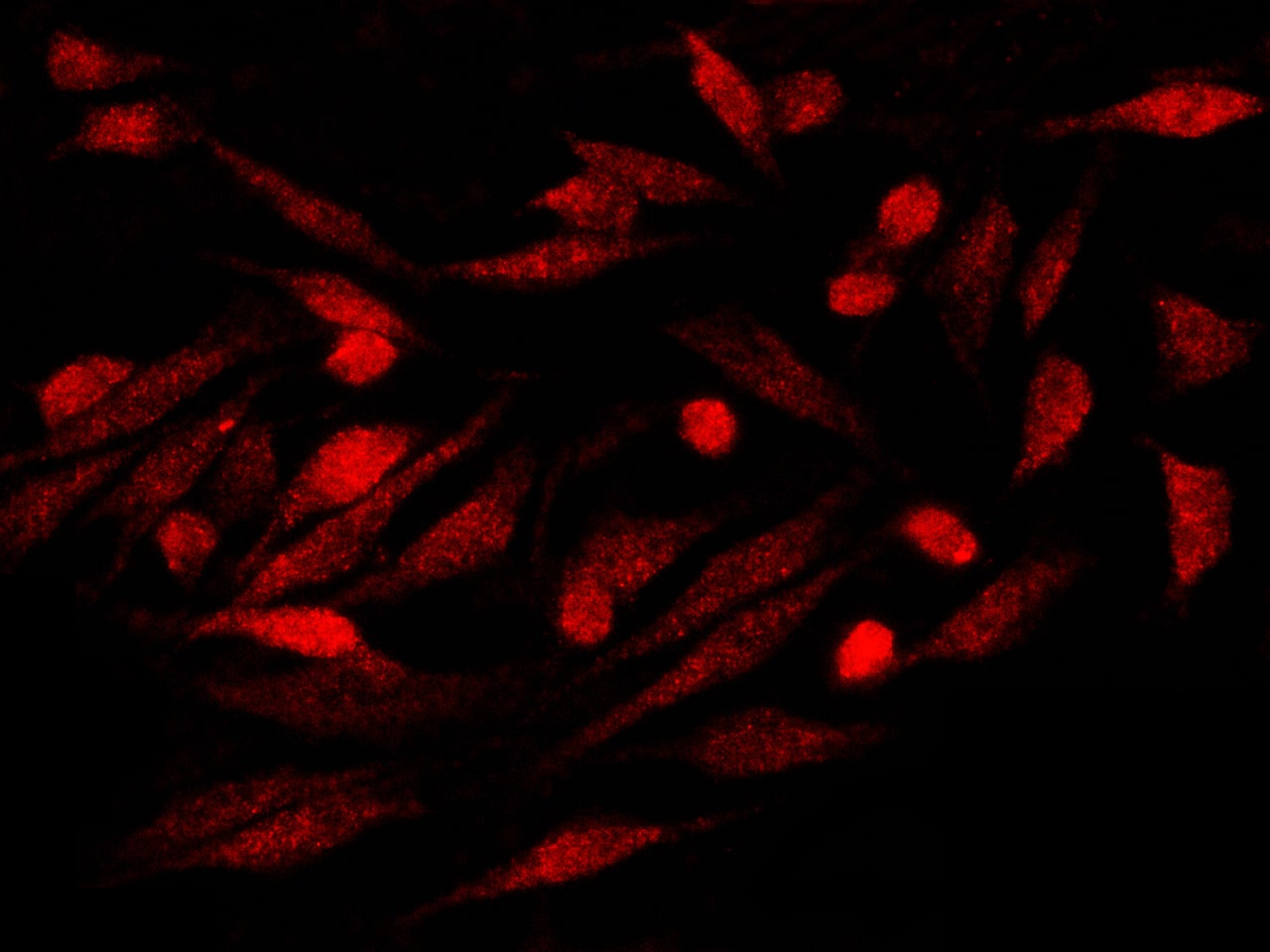 Immunocytochemistry/Immunofluorescence: S100P Antibody (116) [NBP2-90135] - Immunofluorescence staining of S100P in Hela cells. Cells were fixed with 4% PFA, permeabilzed with 0.1% Triton X-100 in PBS,blocked with 10% serum, and incubated with NBP2-90135 antibody (dilution ratio 1:60) at 4? overnight. Then cells were stained with the Alexa Fluor(R)594-conjugated Goat Anti-rabbit IgG secondary antibody (red). Positive staining was localized to Nucleus and Cytoplasm.