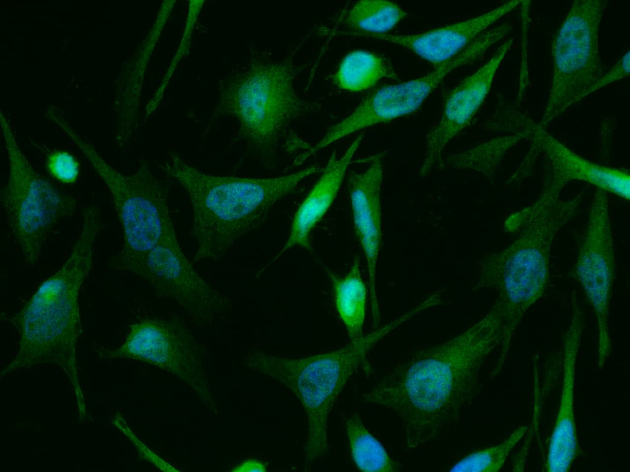 Immunocytochemistry/Immunofluorescence: TSC22/TSC22D1 Antibody (143) [NBP2-90145] - Immunofluorescence staining of Human TSC22D1 in Hela cells. Cells were fixed with 4% PFA, permeabilzed with 0.3% Triton X-100 in PBS, blocked with 10% serum, and incubated with NBP2-90145 antibody (1:60) at 37? 1 hour. Then cells were stained with the Alexa Fluor(R) 488-conjugated Goat Anti-rabbit IgG secondary antibody (green) and counterstained with DAPI (blue). Positive staining was localized to nucleus and cytoplasm.