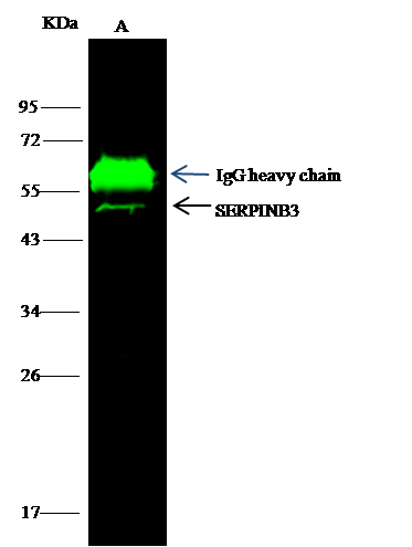 Immunoprecipitation: Serpin B3/SCCA1 Antibody (018) [NBP2-90195] - Lane A:0.5 mg A431 Whole Cell Lysate4 uL anti-SERPINB3 rabbit monoclonal antibody and 15 ul of 50 % Protein G agarose.Primary antibody: NBP2-90195y, at 1:100 dilution, Secondary antibody: Dylight 800-labeled antibody to rabbit IgG (H+L), at 1:5000 dilution, Developed using the odssey technique. Performed under reducing conditions. Predicted band size: 42 kDa Observed band size: 42 kDa