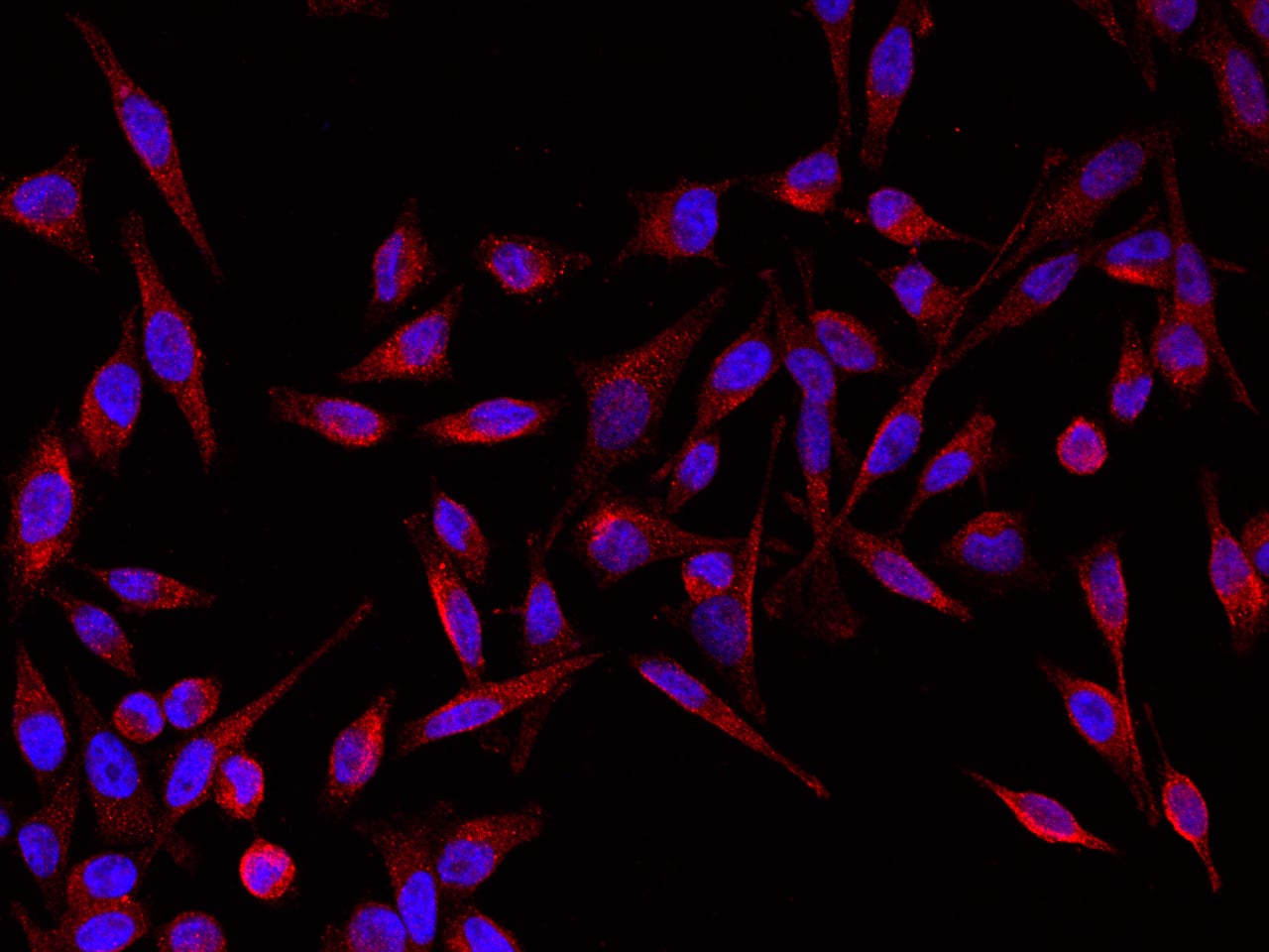 <b>Biological Strategies Validation. </b>Immunocytochemistry/Immunofluorescence: GIF Antibody (007) [NBP2-90225] - Immunofluorescence staining of GIF in Hela cells. Cells were fixed with 4% PFA, permeabilzed with 0.1% Triton X-100 in PBS,blocked with 10% serum, and incubated with NBP2-90225 antibody (dilution ratio 1:60) at 4? overnight. Then cells were stained with the Alexa Fluor(R)594-conjugated Goat Anti-rabbit IgG secondary antibody (red) and counterstained with DAPI (blue).Positive staining was localized to Cytoplasm .