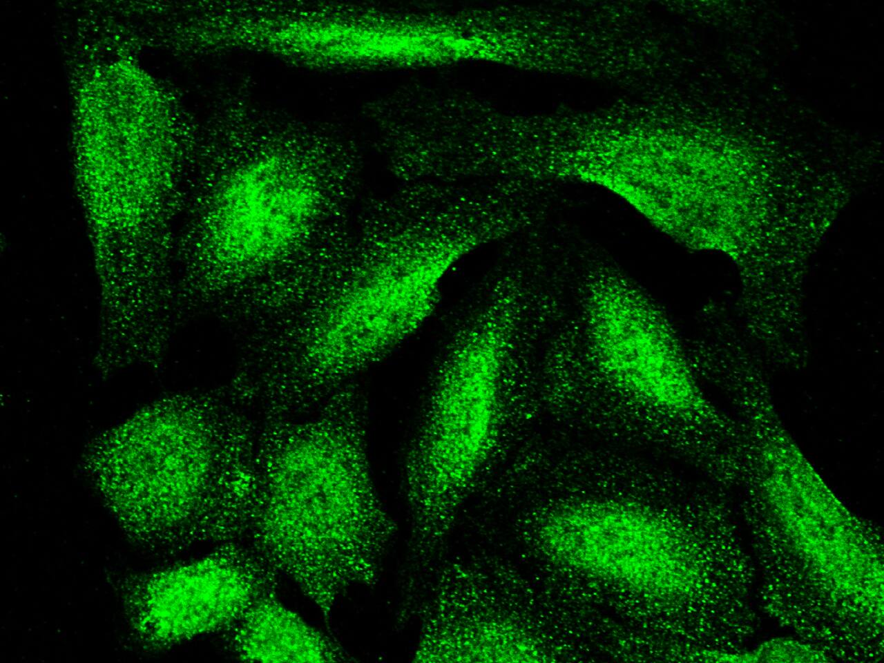 Immunocytochemistry/Immunofluorescence: ARL2BP Antibody (001) [NBP2-90277] - Immunofluorescence staining of ARL2BP in U2OS cells. Cells were fixed with 4% PFA, permeabilzed with 0.3% Triton X-100 in PBS, blocked with 10% serum, and incubated with NBP2-90277 antibody (1:60) at 4C overnight. Then cells were stained with the Alexa Fluor(TM) 488-conjugated Goat Anti-rabbit IgG secondary antibody (green).