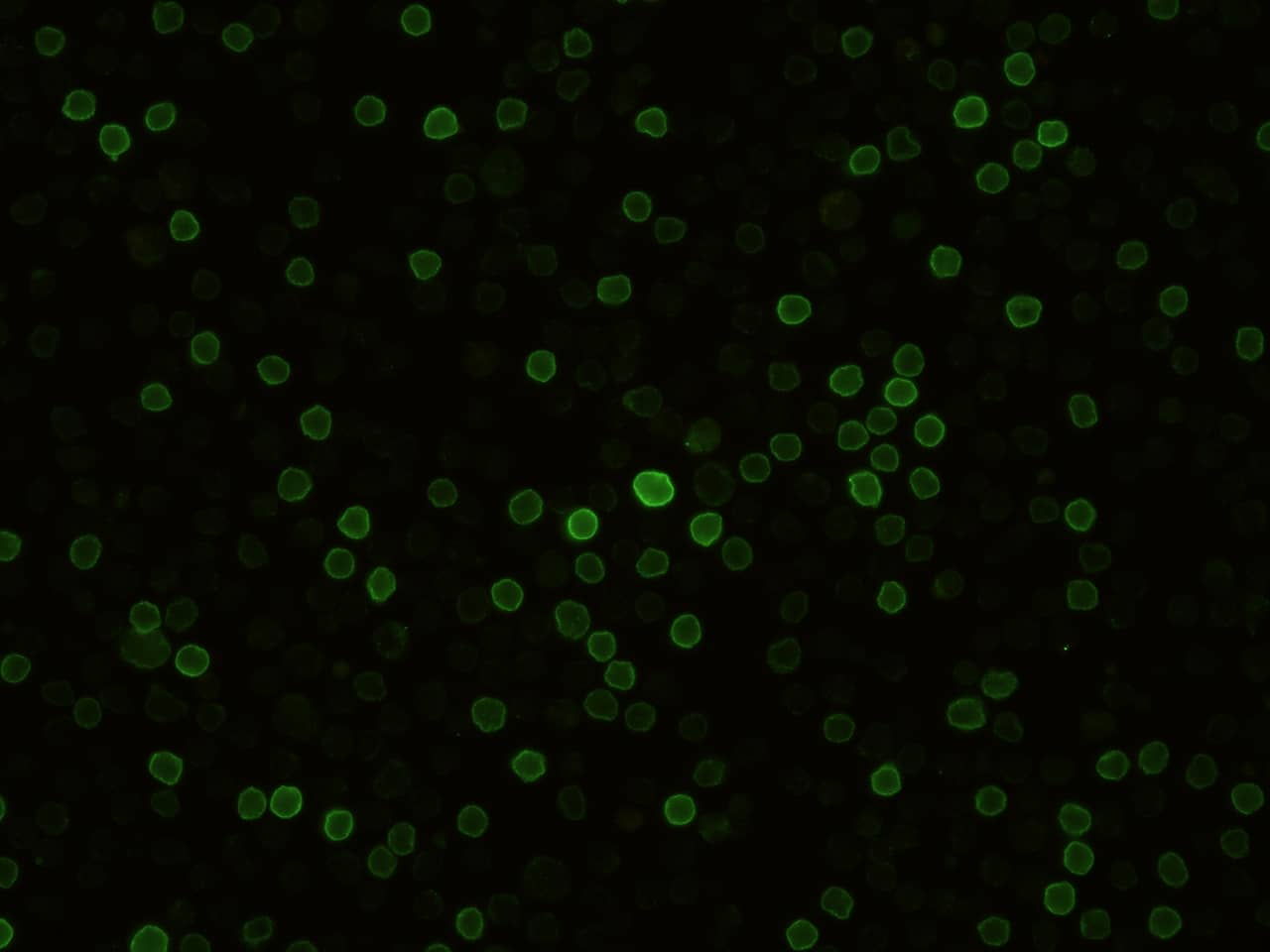 Immunocytochemistry/Immunofluorescence: CD27/TNFRSF7 Antibody (012) [NBP2-90423] - Immunofluorescence staining of Mouse CD27/TNFRSF7 in Mouse Spleen cells. Cells were fixed with 4% PFA, blocked with 10% serum, and incubated with NBP2-90423 antibody (1:60) at 37C 1 hour. Then cells were stained with the Alexa Fluor(R) 488-conjugated Goat Anti-rabbit IgG secondary antibody (green). Positive staining was localized to cell membrane.