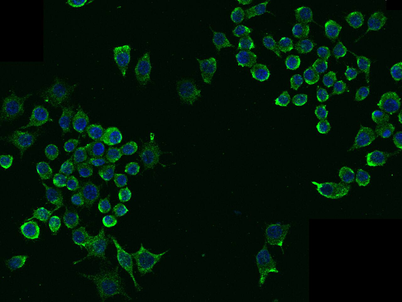 Immunocytochemistry/Immunofluorescence: LDLR Antibody (101) [NBP2-90524] - Immunofluorescence staining of mLDLR in RAW264.7 cells. Cells were fixed with 4% PFA, blocked with 10% serum, and incubated with NBP2-90524 antibody (dilution ratio 1:60) at 4C overnight. Then cells were stained with the Alexa Fluor(R)488-conjugated Goat Anti-rabbit IgG secondary antibody (green) and counterstained with DAPI (blue).Positive staining was localized to Cytoplasm .
