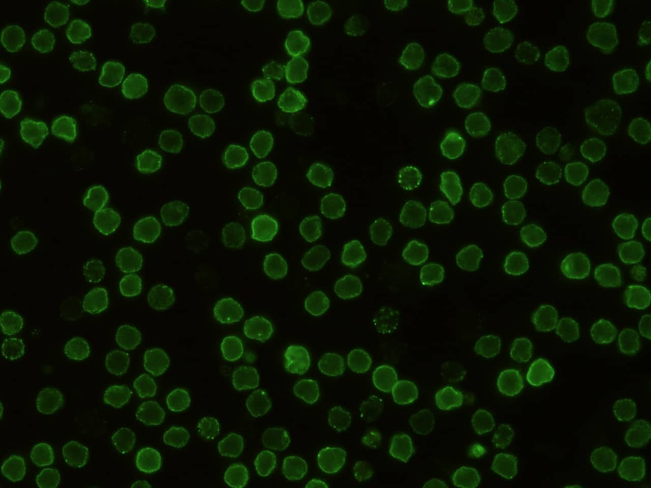 Immunocytochemistry/Immunofluorescence: CD48/SLAMF2 Antibody (341) [NBP2-90577] - Immunofluorescence staining of Mouse CD48/SLAMF2 in Mouse Spleen cells. Cells were fixed with 4% PFA, blocked with 10% serum, and incubated with NBP2-90577 antibody (1:60) at 37C 1 hour. Then cells were stained with the Alexa Fluor(R) 488-conjugated Goat Anti-rabbit IgG Secondary antibody (green). Positive staining was localized to cell membrane.