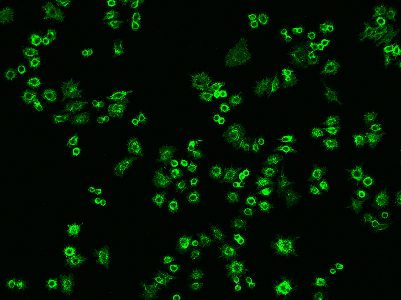Immunocytochemistry/Immunofluorescence: ICAM-1/CD54 Antibody (009) [NBP2-90585] - Immunofluorescence staining of Mouse ICAM-1/CD54 in Raw264.7 cells. Cells were fixed with 4% PFA, blocked with 10% serum, and incubated with NBP2-90585 antibody (dilution ratio 1:60) at 4C overnight. Then cells were stained with the Alexa Fluor(R)488-conjugated Goat Anti-rabbit IgG Secondary antibody (green). Positive staining was localized to Cytoplasm and Cell membrane.