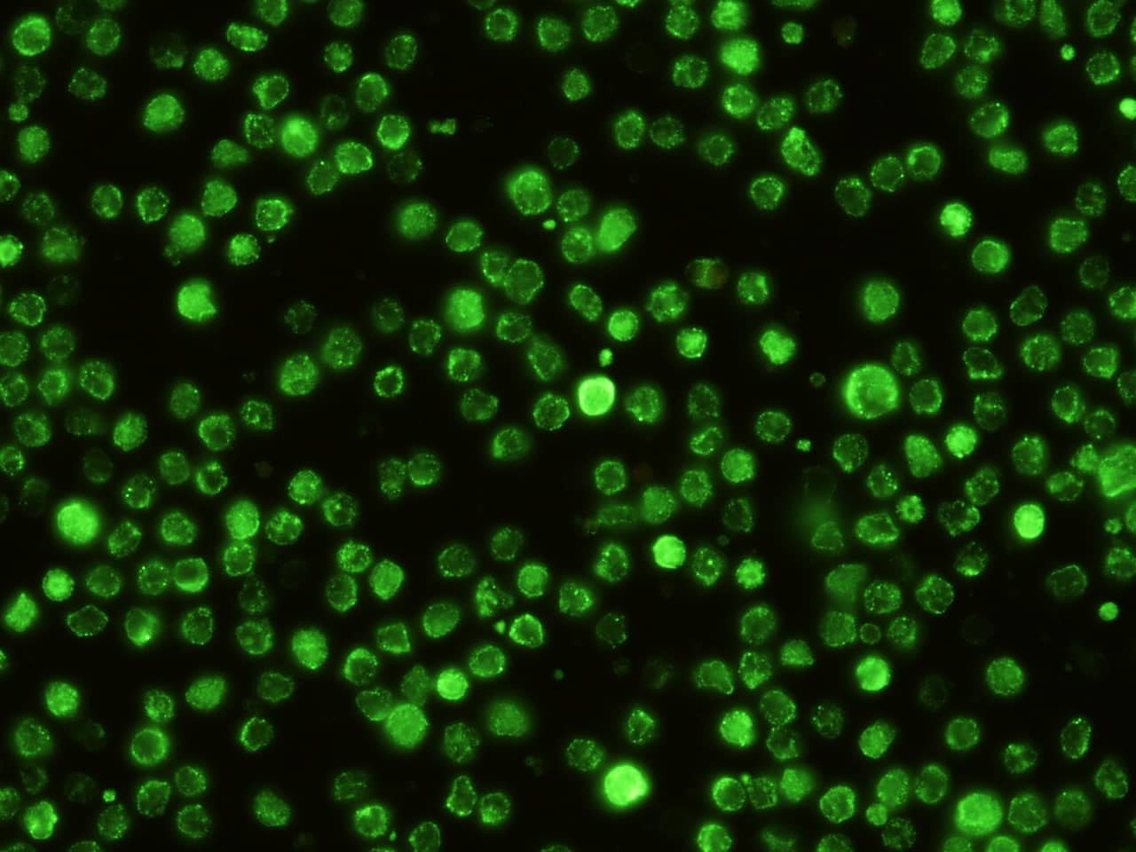 Immunocytochemistry/Immunofluorescence: SIGNR1/CD209b Antibody (143) [NBP2-90609] - Immunofluorescence staining of mouse SIGNR1/CD209b in mouse splenocytes. Cells were fixed with 4% PFA, blocked with 10% serum, and incubated with NBP2-90609 antibody (1:60) at 37C 1 hour. Then cells were stained with the Alexa Fluor(R) 488-conjugated Goat Anti-rabbit IgG Secondary antibody (green).