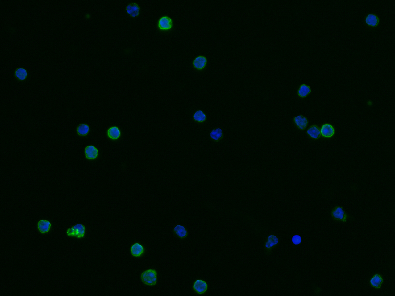 Immunocytochemistry/Immunofluorescence: CD23/Fc epsilon RII Antibody (007) [NBP2-90682] - Immunofluorescence staining of mouse CD23/Fc epsilon RII in mouse splenocytes. Cells were fixed with 4% PFA, blocked with 10% serum, and incubated with NBP2-90682 antibody (1:60) at 4C overnight. Then cells were stained with the Alexa Fluor(R) 488-conjugated Goat Anti-rabbit IgG Secondary antibody (green) and counterstained with DAPI (blue).