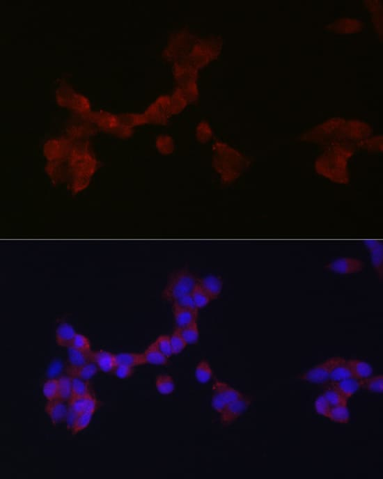 Immunocytochemistry/ Immunofluorescence: DAB1 Antibody - Azide and BSA Free [NBP2-92015] - Immunofluorescence analysis of SH-SY5Y cells using DAB1 Rabbit pAb  at dilution of 1:200 (40x lens). Secondary antibody: Cy3-conjugated Goat anti-Rabbit IgG (H+L)  at 1:500 dilution. Blue: DAPI for nuclear staining.