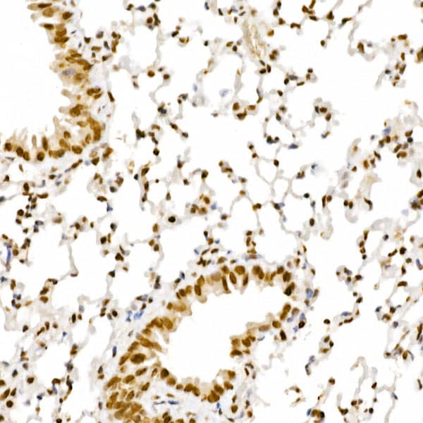 Immunohistochemistry: ALKBH5 Antibody - Azide and BSA Free [NBP2-92048] - Immunohistochemistry analysis of paraffin-embedded Mouse lung using ALKBH5 Rabbit pAb  at dilution of 1:100 (40x lens). High pressure antigen retrieval performed with 0.01M Citrate Bufferr (pH 6.0) prior to IHC staining.