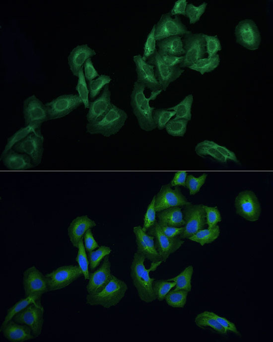 Immunocytochemistry/ Immunofluorescence: AGTRAP Antibody - Azide and BSA Free [NBP2-92060] - Immunofluorescence analysis of U2OS cells using AGTRAP Rabbit pAb  at dilution of 1:100 (40x lens). Secondary antibody: Cy3 Goat Anti-Rabbit IgG (H+L)  at 1:500 dilution. Blue: DAPI for nuclear staining.