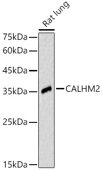 Western Blot: calcium homeostasis modulator 2 Antibody - Azide and BSA Free [NBP2-92100] - Western blot analysis of Rat lung, using calcium homeostasis modulator 2 antibody  at  1:500 dilution.Secondary antibody: HRP Goat Anti-Rabbit IgG (H+L)  at 1:10000 dilution.Lysates/proteins: 25ug per lane.Blocking buffer: 3% nonfat dry milk in TBST.Detection: ECL Enhanced Kit.Exposure time: 60s.