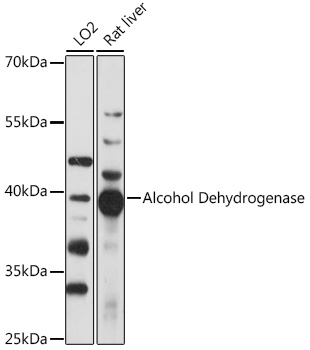 Western Blot: alcohol dehydrogenase Antibody - Azide and BSA Free [NBP2-92180] - Western blot analysis of various lysates using alcohol dehydrogenase Rabbit pAb  at 1:1000 dilution.Secondary antibody: HRP Goat Anti-Rabbit IgG (H+L)  at 1:10000 dilution.Lysates/proteins: 25ug per lane.Blocking buffer: 3% nonfat dry milk in TBST.Detection: ECL Basic Kit.Exposure time: 30s.