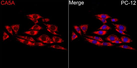 Immunocytochemistry/ Immunofluorescence: Carbonic Anhydrase VA/CA5A Antibody - Azide and BSA Free [NBP2-92181] - Immunofluorescence analysis of PC-12 cells using Carbonic Anhydrase VA/CA5A Rabbit pAb  at dilution of 1:100 (40x lens). Secondary antibody: Cy3-conjugated Goat anti-Rabbit IgG (H+L)  at 1:500 dilution. Blue: DAPI for nuclear staining.