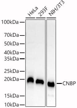 Western Blot: CNBP Antibody - Azide and BSA Free [NBP2-92206] - Western blot analysis of various lysates, using CNBP Rabbit pAb  at  1:800 dilution.&lt;br&gt;Secondary antibody: HRP-conjugated Goat anti-Rabbit IgG (H+L)  at 1:10000 dilution.&lt;br&gt;Lysates/proteins: 25ug per lane.&lt;br&gt;Blocking buffer: 3% nonfat dry milk in TBST.&lt;br&gt;Detection: ECL Basic Kit.&lt;br&gt;Exposure time: 60s.