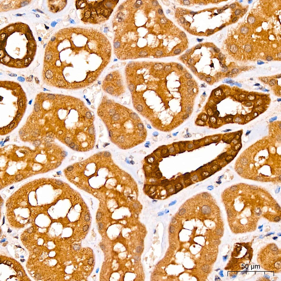 Immunohistochemistry: CNBP Antibody - Azide and BSA Free [NBP2-92206] - Immunohistochemistry analysis of paraffin-embedded Human kidney tissue using CNBP Rabbit pAb  at a dilution of 1:100 (40x lens). High pressure antigen retrieval was performed with 0.01 M citrate buffer (pH 6.0) prior to IHC staining.