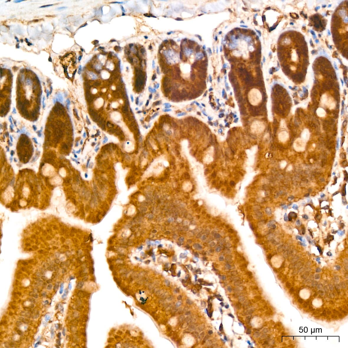 Immunohistochemistry: CNBP Antibody - Azide and BSA Free [NBP2-92206] - Immunohistochemistry analysis of paraffin-embedded Mouse colon tissue using CNBP Rabbit pAb  at a dilution of 1:100 (40x lens). High pressure antigen retrieval was performed with 0.01 M citrate buffer (pH 6.0) prior to IHC staining.