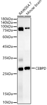 Western Blot: CEBP Delta Antibody - Azide and BSA Free [NBP2-92220] - Western blot analysis of extracts of various cell lines, using CEBP Delta antibody  at  1:1000 dilution.Secondary antibody: HRP Goat Anti-Rabbit IgG (H+L)  at 1:10000 dilution.Lysates/proteins: 25ug per lane.Blocking buffer: 3% nonfat dry milk in TBST.Detection: ECL Basic Kit.Exposure time: 30s.