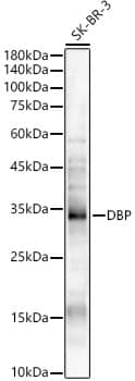 Western Blot: D Box Binding Protein Antibody - Azide and BSA Free [NBP2-92224] - Western blot analysis of lysates from SK-BR-3 cells, using D Box Binding Protein Rabbit pAb  at 1:400 dilution.Secondary antibody: HRP-conjugated Goat anti-Rabbit IgG (H+L)  at 1:10000 dilution.Lysates/proteins: 25ug per lane.Blocking buffer: 3% nonfat dry milk in TBST.Detection: ECL Enhanced Kit.Exposure time: 30s.