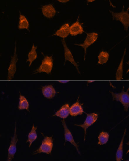 Immunocytochemistry/ Immunofluorescence: Advillin Antibody - Azide and BSA Free [NBP2-92263] - Immunofluorescence analysis of L929 cells using Advillin Rabbit pAb  at dilution of 1:100. Secondary antibody: Cy3 Goat Anti-Rabbit IgG (H+L)  at 1:500 dilution. Blue: DAPI for nuclear staining.