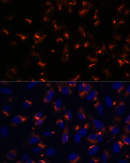 Immunocytochemistry/ Immunofluorescence: CCDC47 Antibody - Azide and BSA Free [NBP2-92269] - Immunofluorescence analysis of U-2 OS cells using CCDC47 Rabbit pAb  at dilution of 1:100. Secondary antibody: Cy3 Goat Anti-Rabbit IgG (H+L)  at 1:500 dilution. Blue: DAPI for nuclear staining.